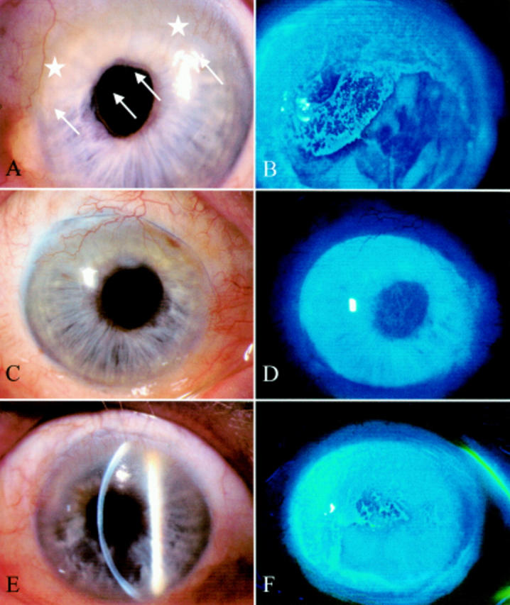 Figure 4  