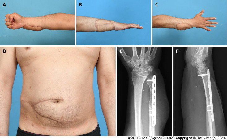 Figure 4