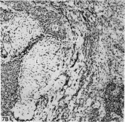 Fig. 7B