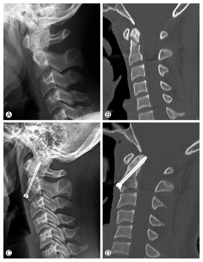 Fig. 2