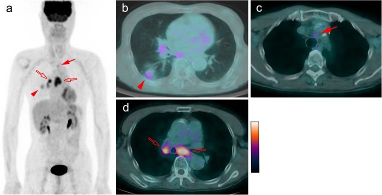 Fig. 1