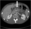 Fig. 1