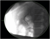 Fig. 3
