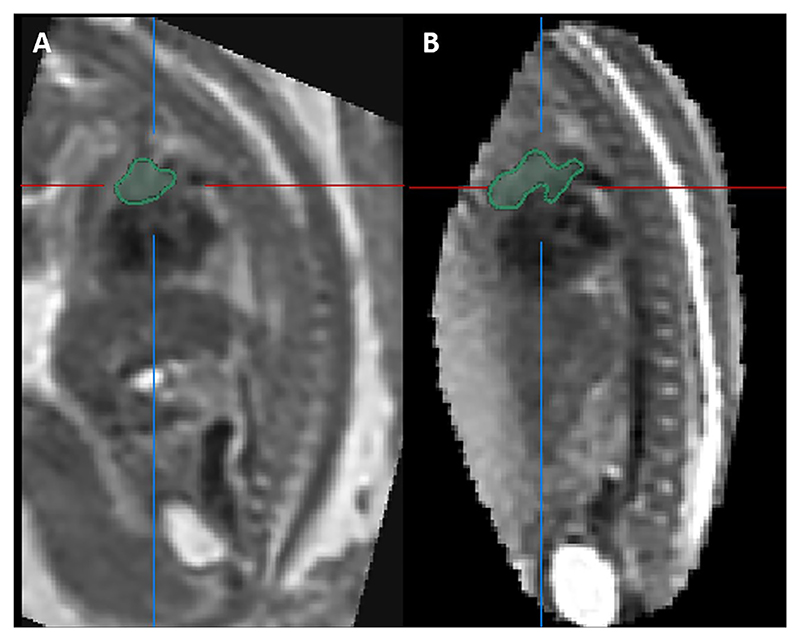 Fig. 7