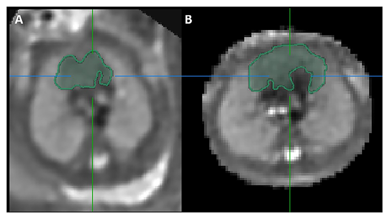 Fig. 5