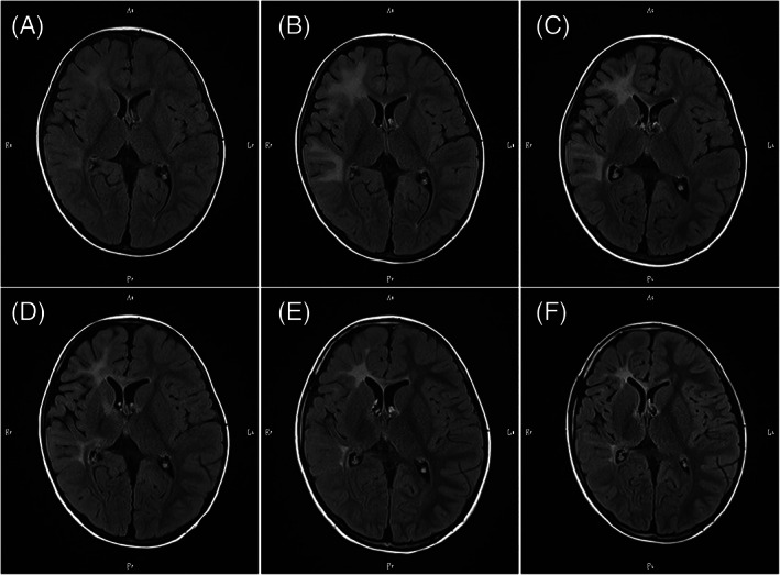 FIGURE 1