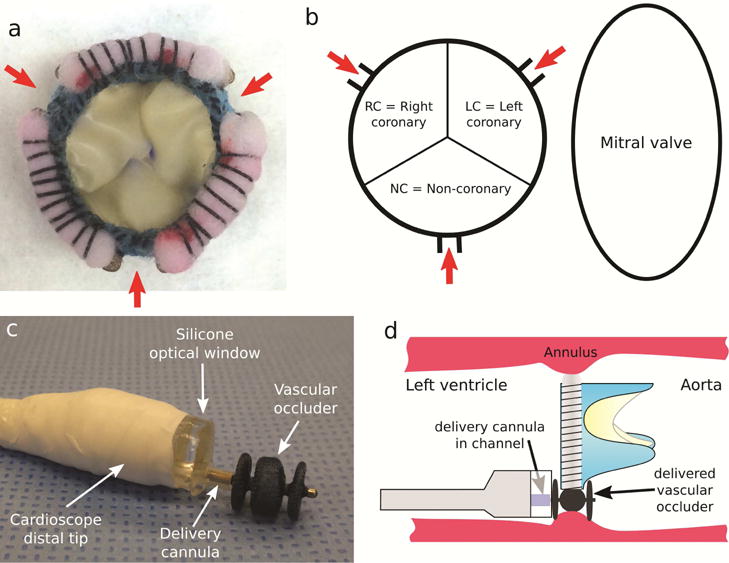 Fig. 2