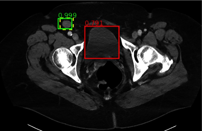 Fig. 21