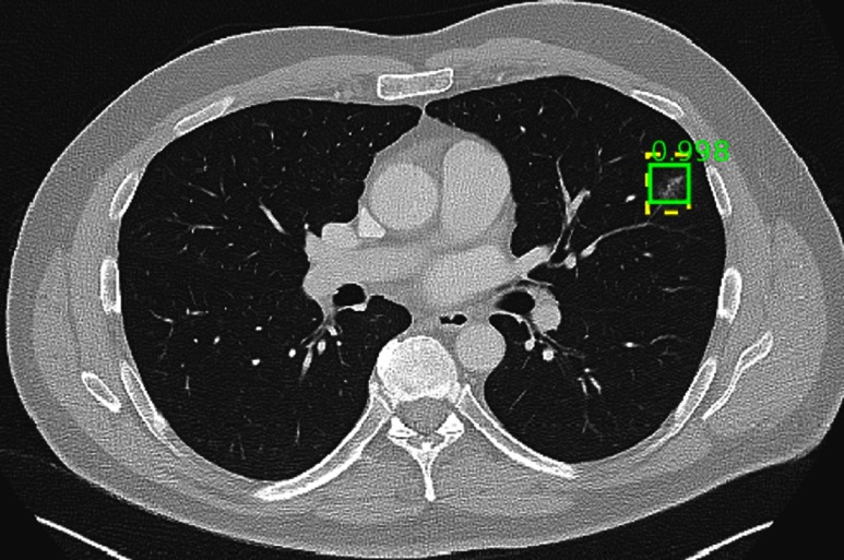 Fig. 14