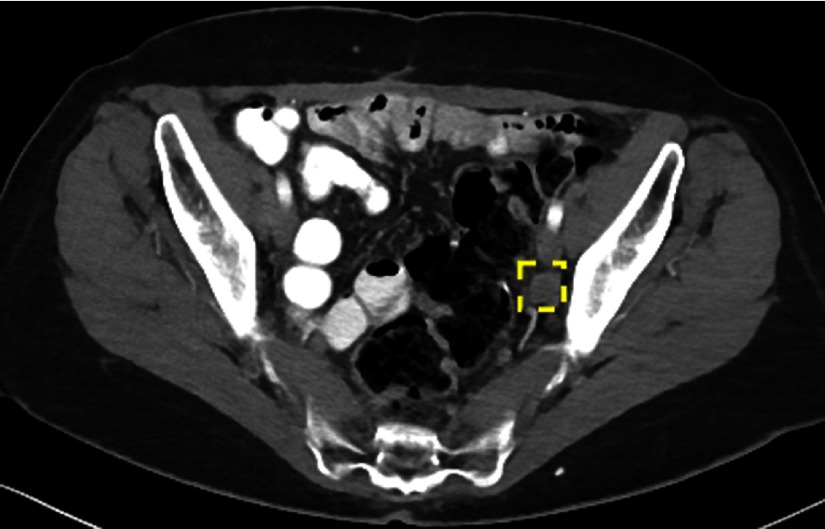 Fig. 20