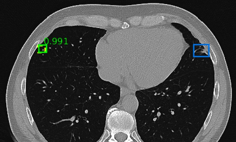 Fig. 12