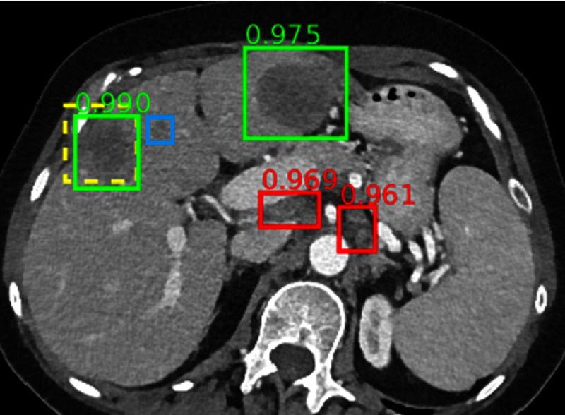 Fig. 18