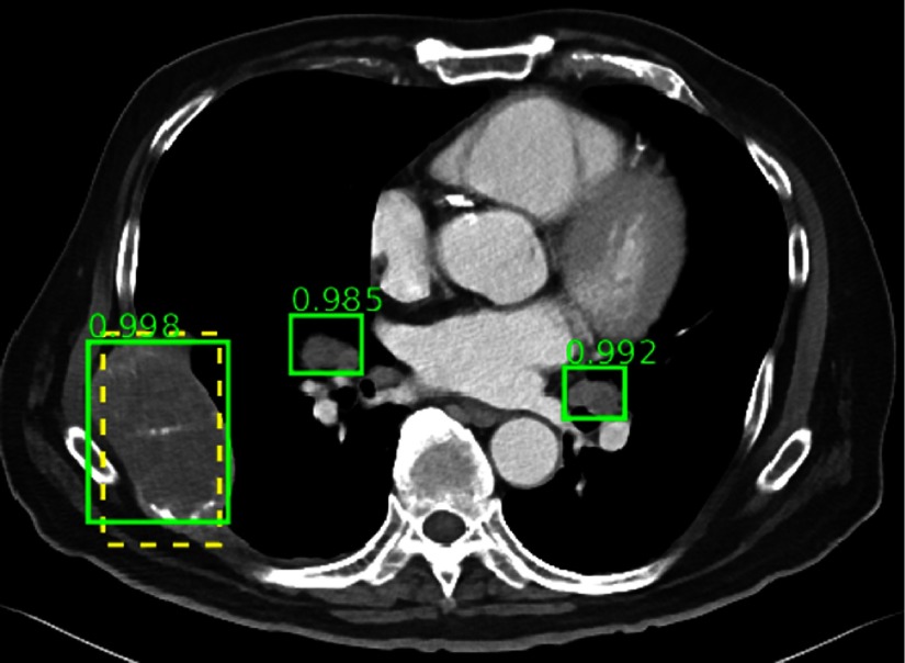 Fig. 17