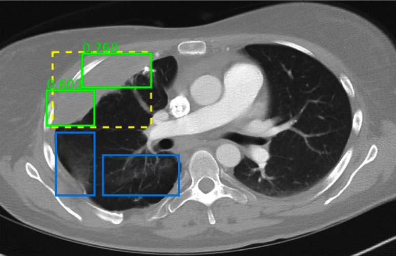 Fig. 13