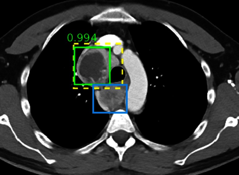 Fig. 16