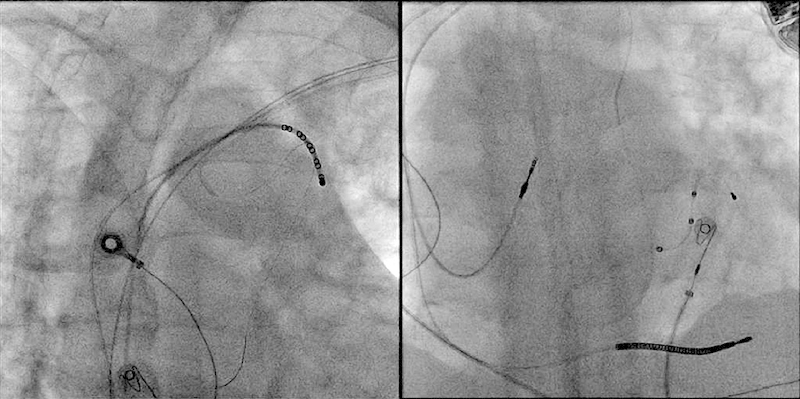 Fig. 2