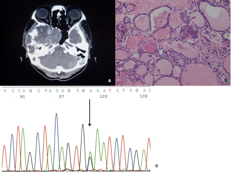 Fig. 1