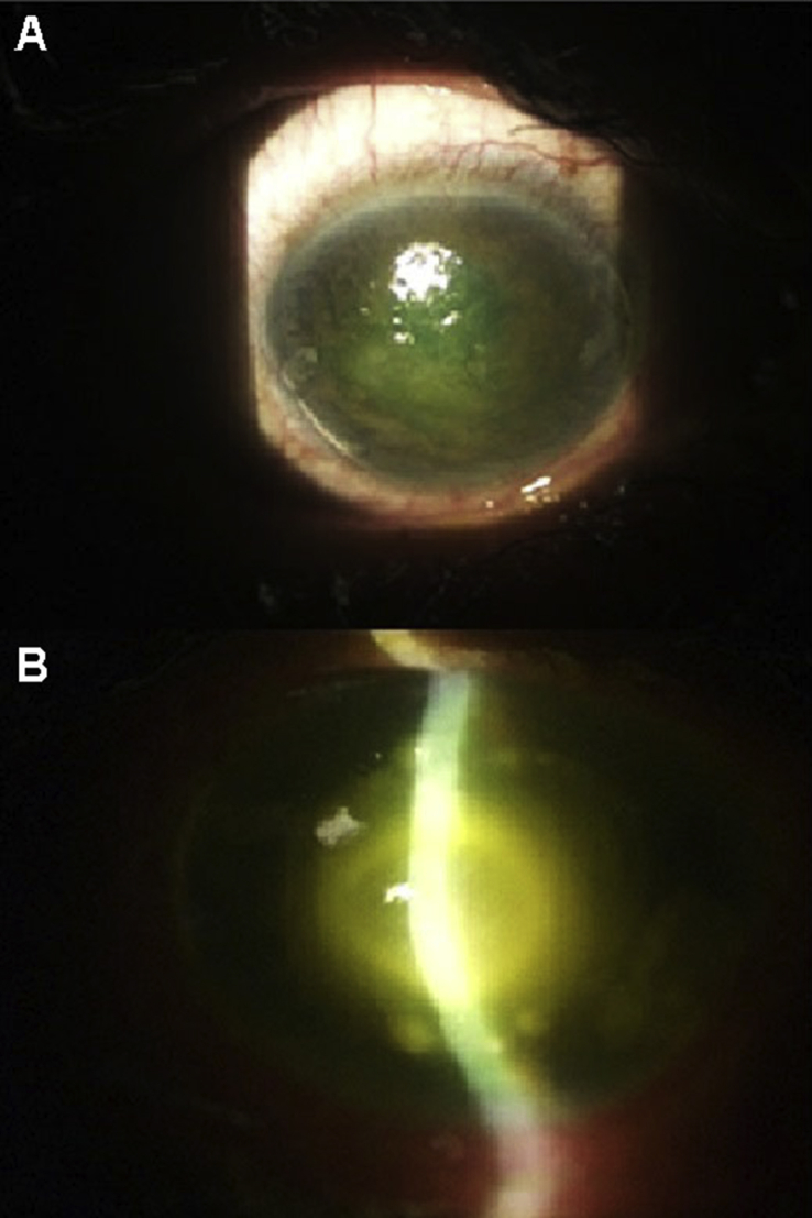 Fig. 1