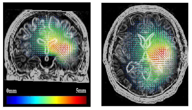 Fig. 10