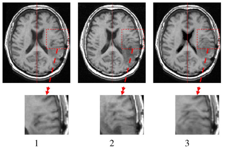 Fig. 11