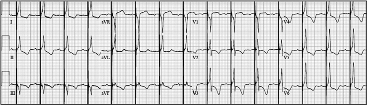 Fig. 1