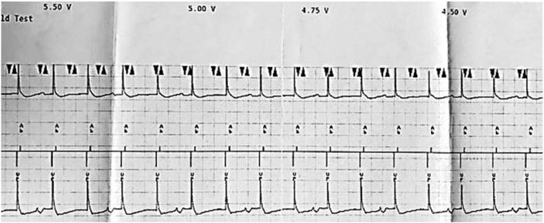 Fig. 8A