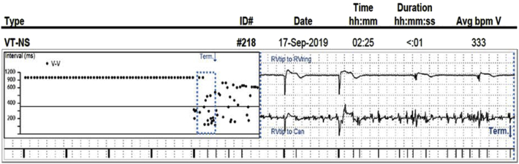 Fig. 4B