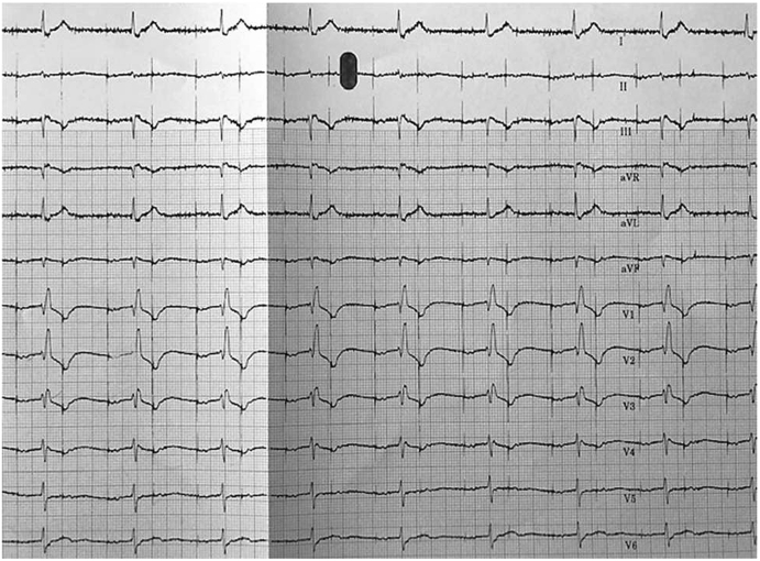 Fig. 8B