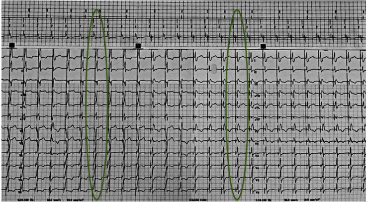 Fig. 3