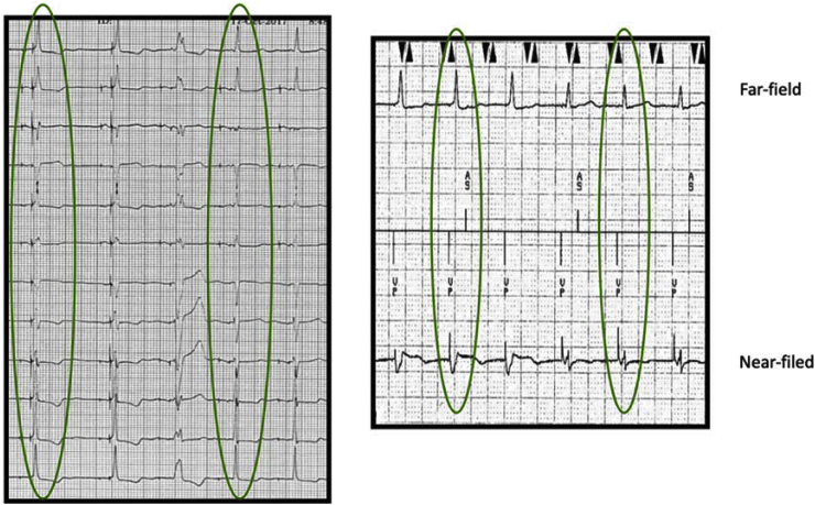 Fig. 6