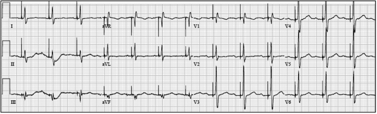 Fig. 2