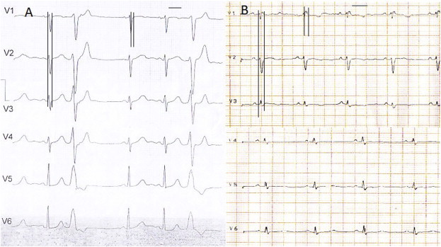 Fig. 1