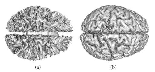 Figure 14