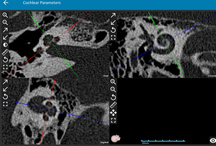 Fig. 1