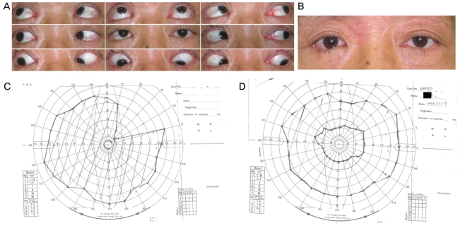 Fig. 2