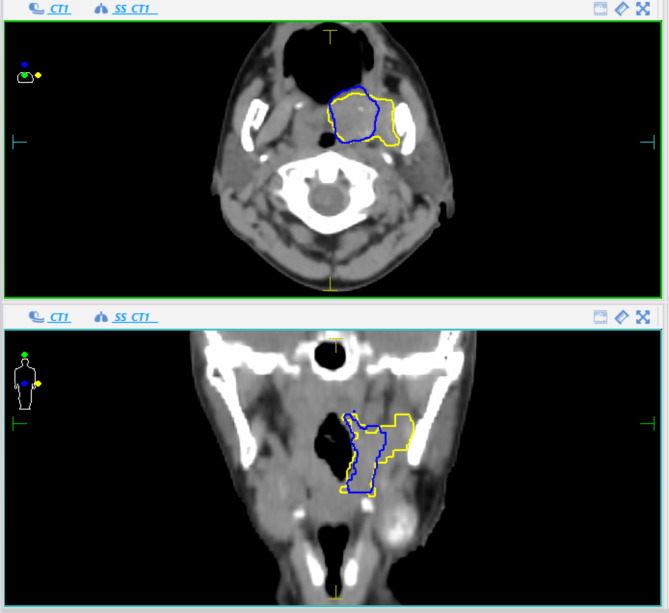 Fig. 2b