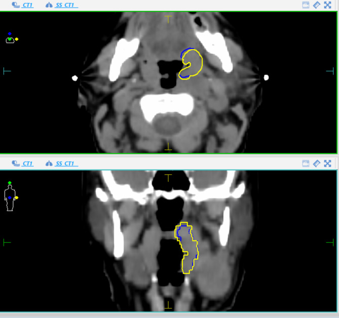 Fig. 2a