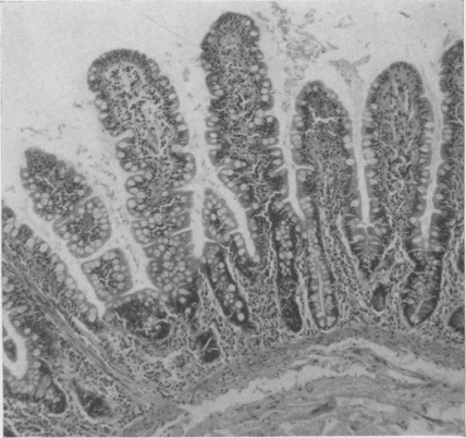 Fig. 11b