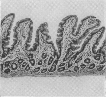 Fig. 2b