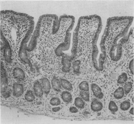 Fig. 9b