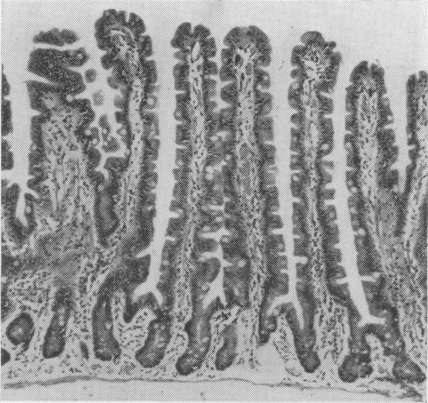 Fig. 1b