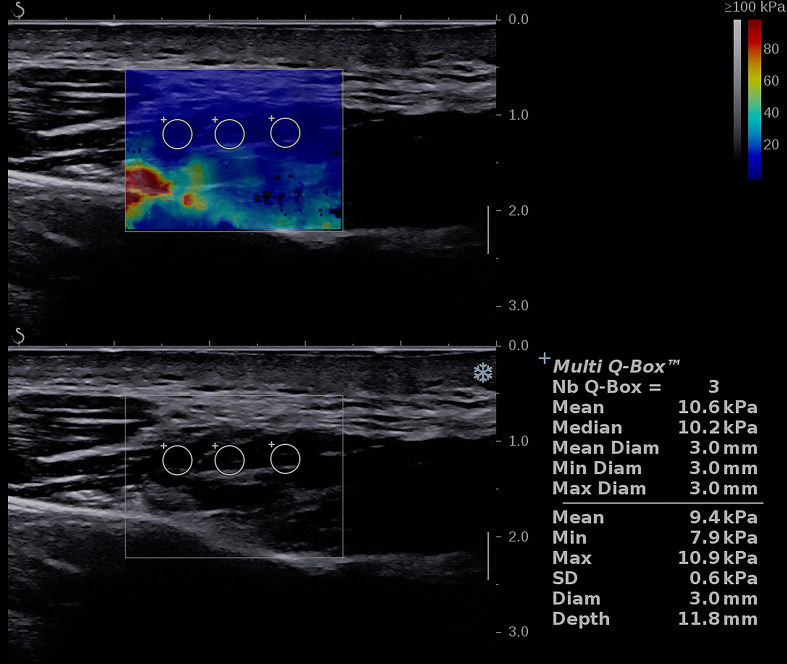 Figure 2.