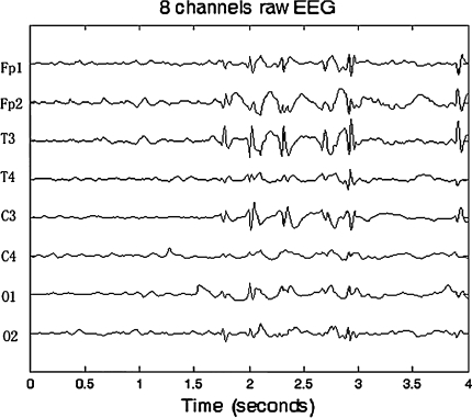 Fig. 3