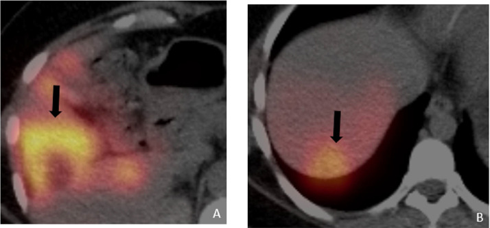 Figure 2 –