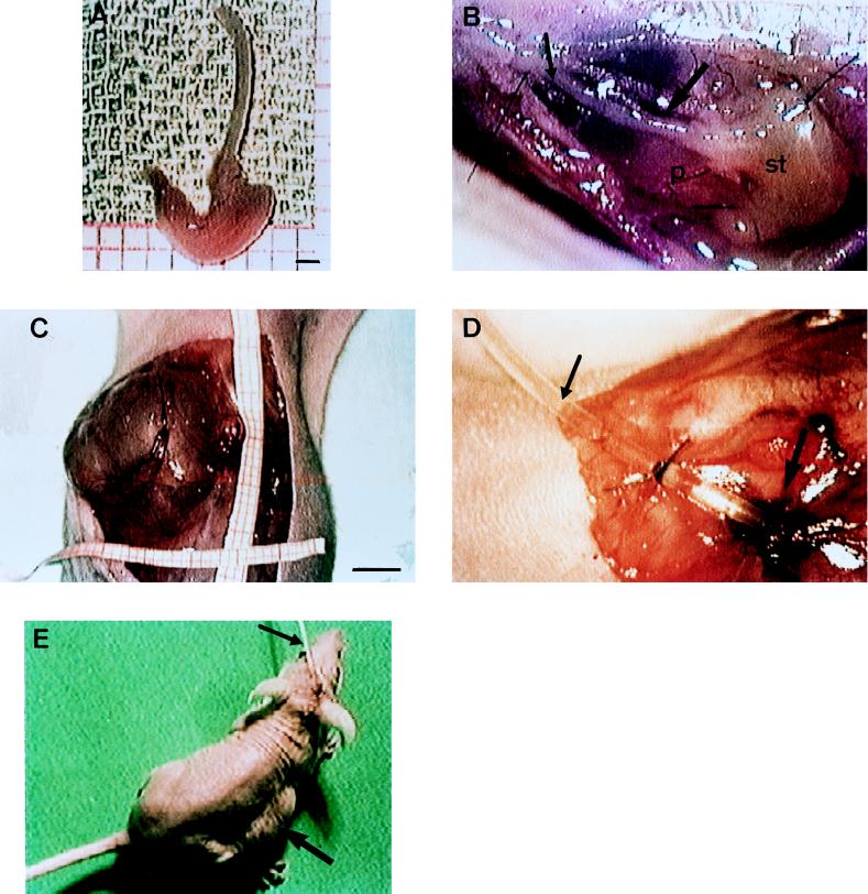 FIG. 1