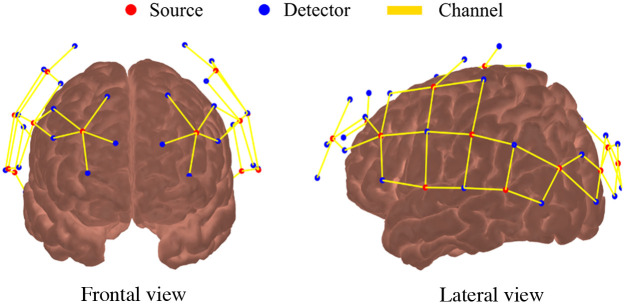 Fig. 1