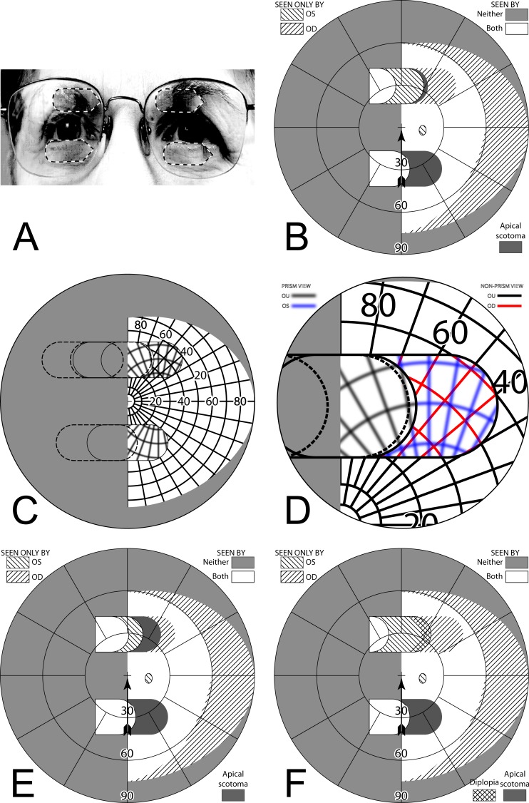 Figure 15. 