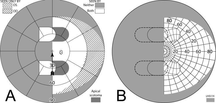 Figure 14. 