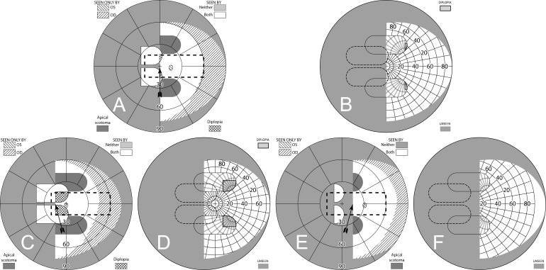 Figure 17. 