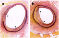 Fig. (1)